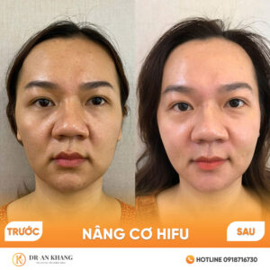 nang-co-hifu-01