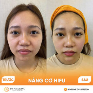 nang-co-hifu-02
