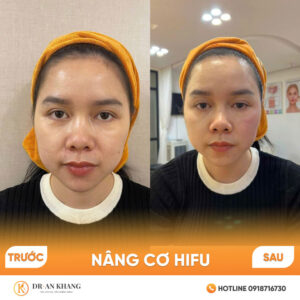 nang-co-hifu-03