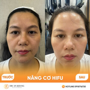 nang-co-hifu-04